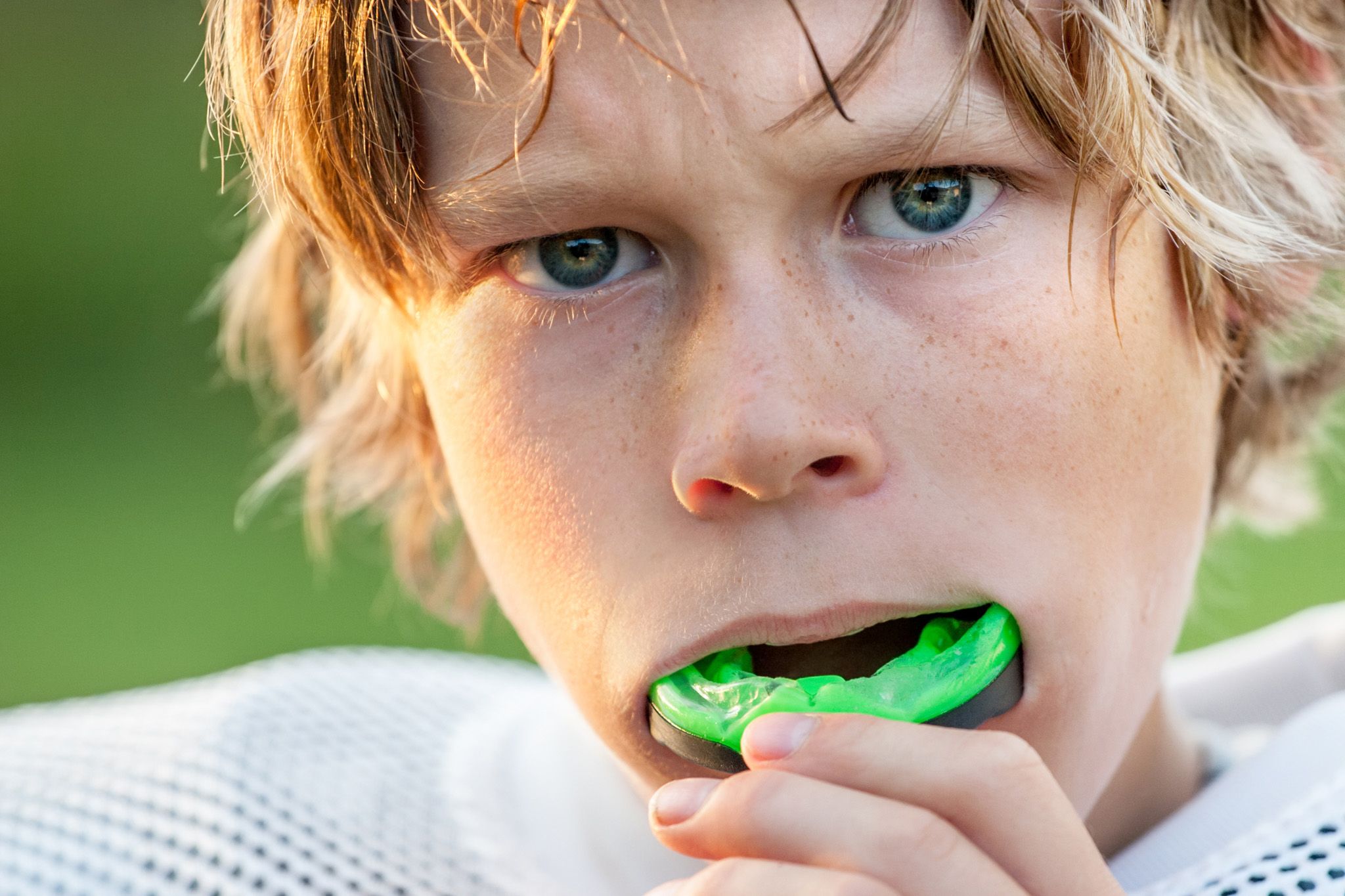 Mouth Guards - Boy with sports guard in mouth