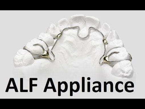 trenton-dentist-Alf-Appliance